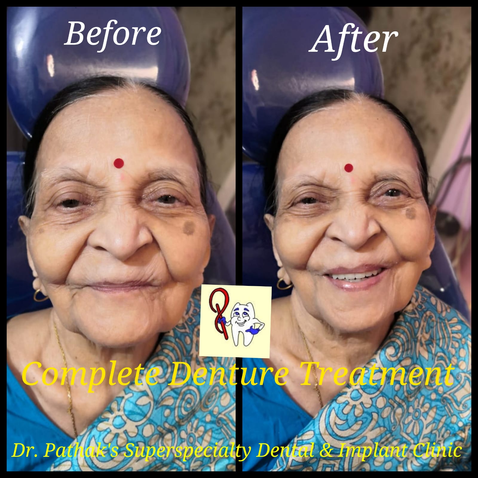 Dr. Pathak's Superspecialty Dental & Implant Clinic